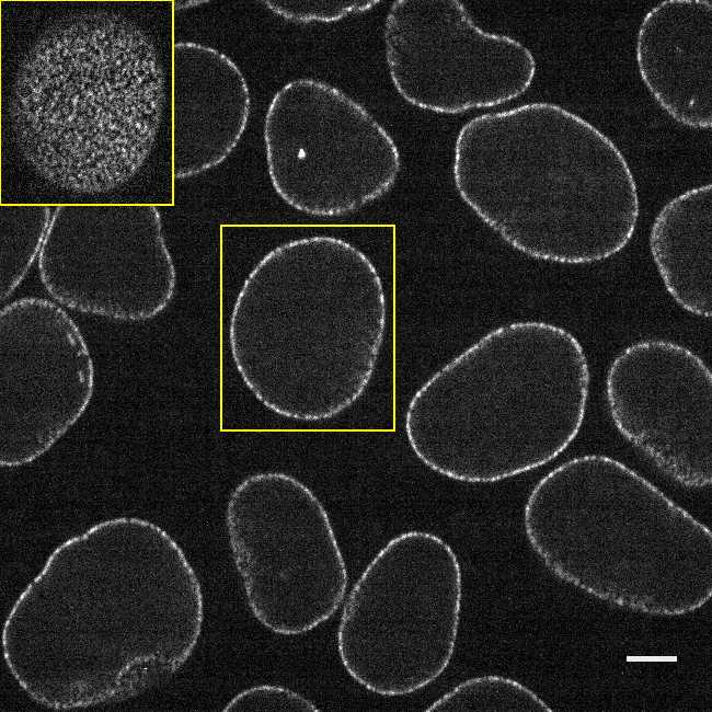 [object Object] thumbnail