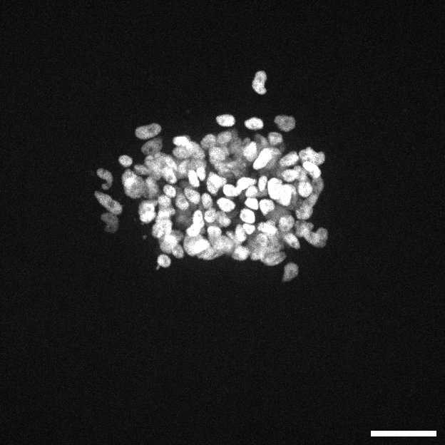 [object Object] thumbnail