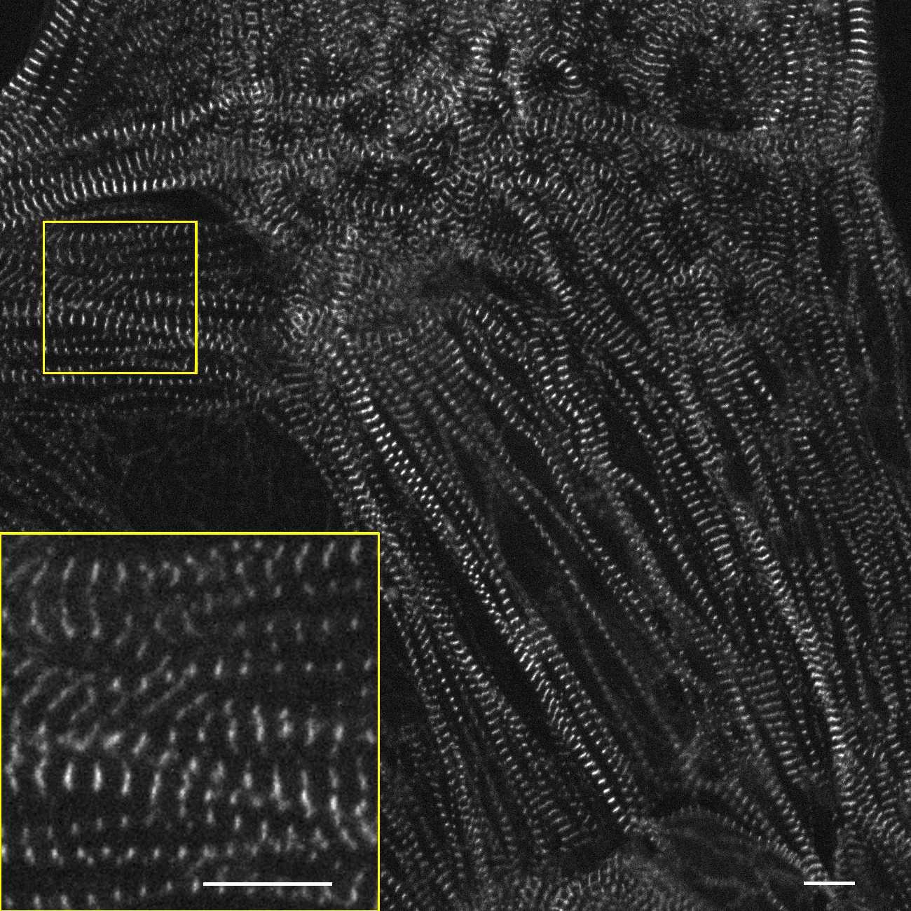 [object Object] thumbnail